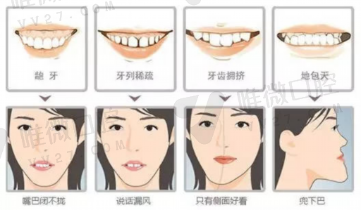 瓷贴面掉了可以不再做吗（瓷贴面脱落了,还可以再粘吗）(图1)
